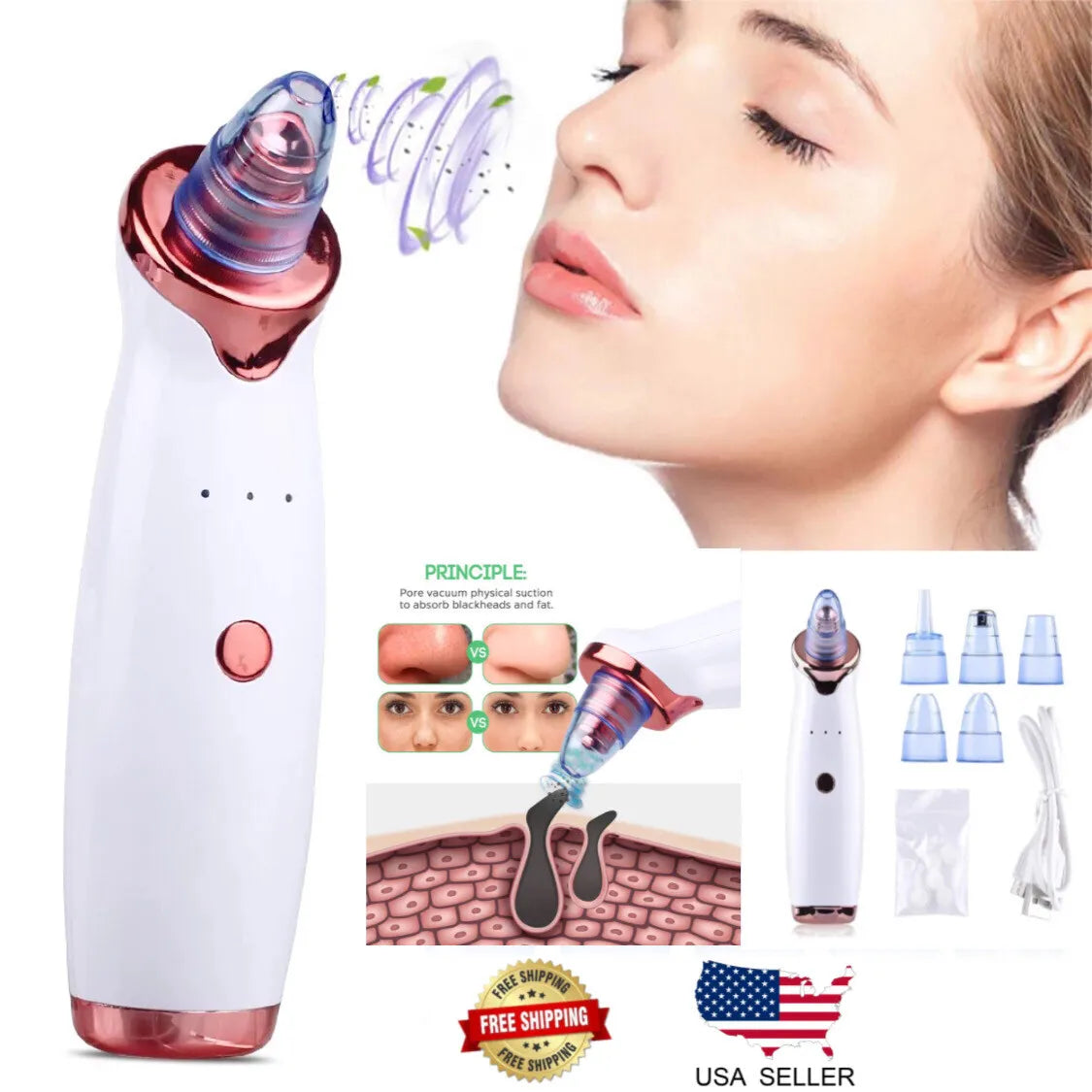 Electric Facial Comedo Pimple Extractor Pore Cleaner  Remover My Store