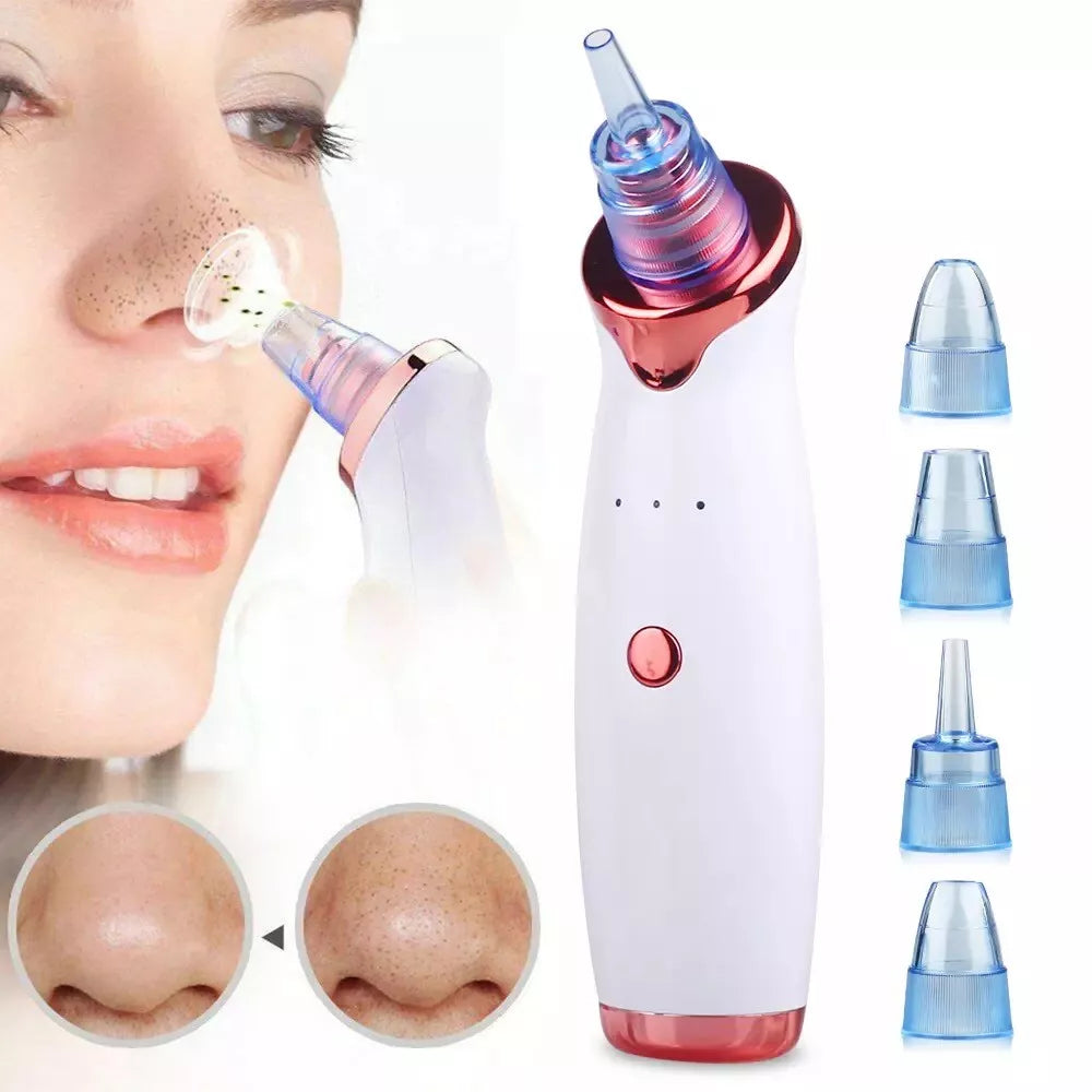 Electric Facial Comedo Pimple Extractor Pore Cleaner  Remover My Store